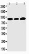 Transient receptor potential cation channel subfamily V member 3 antibody, PA1978, Boster Biological Technology, Western Blot image 