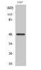 Casein Kinase 1 Gamma 1 antibody, STJ92012, St John