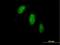 Tigger Transposable Element Derived 1 antibody, H00200765-B01P, Novus Biologicals, Immunocytochemistry image 