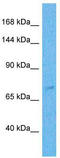 Zinc Finger Protein 471 antibody, TA329418, Origene, Western Blot image 
