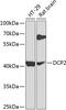Decapping MRNA 2 antibody, GTX32554, GeneTex, Western Blot image 