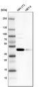 Small ArfGAP2 antibody, HPA021466, Atlas Antibodies, Western Blot image 