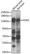 Pumilio RNA Binding Family Member 1 antibody, 22-010, ProSci, Western Blot image 