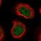 Chromosome 8 Open Reading Frame 44 antibody, PA5-60454, Invitrogen Antibodies, Immunofluorescence image 