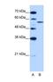 U2 small nuclear ribonucleoprotein auxiliary factor 35 kDa subunit-related protein 2 antibody, NBP1-57317, Novus Biologicals, Western Blot image 