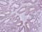 Protein Kinase CAMP-Dependent Type II Regulatory Subunit Beta antibody, PA5-28266, Invitrogen Antibodies, Immunohistochemistry frozen image 