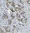 Catenin Alpha 1 antibody, M01617-1, Boster Biological Technology, Immunohistochemistry paraffin image 