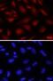 Forkhead Box P2 antibody, AF5647, R&D Systems, Immunocytochemistry image 
