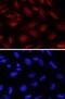 Forkhead Box P2 antibody, AF5647, R&D Systems, Immunocytochemistry image 