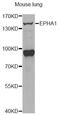 Ephrin type-A receptor 1 antibody, LS-C748359, Lifespan Biosciences, Western Blot image 