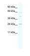 Spi-1 Proto-Oncogene antibody, orb329605, Biorbyt, Western Blot image 