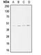 Actin Related Protein 3 antibody, LS-C353223, Lifespan Biosciences, Western Blot image 