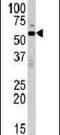 ERK-7 antibody, PA5-14488, Invitrogen Antibodies, Western Blot image 