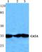 Carbonic Anhydrase 5A antibody, A09582-1, Boster Biological Technology, Western Blot image 