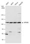 Vacuolar protein sorting-associated protein 18 homolog antibody, GTX130176, GeneTex, Western Blot image 