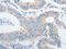 Insulin Like Growth Factor Binding Protein 1 antibody, CSB-PA197609, Cusabio, Immunohistochemistry paraffin image 