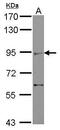 Zinc finger MIZ domain-containing protein 2 antibody, PA5-31271, Invitrogen Antibodies, Western Blot image 