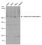 Acetyl-CoA carboxylase antibody, PA5-77844, Invitrogen Antibodies, Western Blot image 