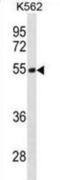 Testin LIM Domain Protein antibody, abx031304, Abbexa, Western Blot image 