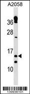 Thioredoxin reductase 3 intronic transcript 1 antibody, 60-319, ProSci, Western Blot image 