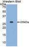 Matrix Metallopeptidase 15 antibody, MBS2015357, MyBioSource, Western Blot image 