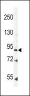 Leptin Receptor antibody, 62-143, ProSci, Western Blot image 