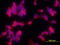 Integrin Subunit Alpha V antibody, MAB1219, R&D Systems, Immunocytochemistry image 