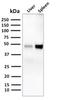 CD209 Molecule antibody, GTX34673, GeneTex, Western Blot image 