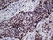Transcription Factor 12 antibody, LS-C795079, Lifespan Biosciences, Immunohistochemistry paraffin image 