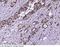 EGFR antibody, 10001-MM11, Sino Biological, Immunohistochemistry paraffin image 