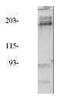 Insulin Receptor Substrate 2 antibody, PA1-30707, Invitrogen Antibodies, Western Blot image 