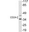 CD24 Molecule antibody, LS-C292238, Lifespan Biosciences, Western Blot image 