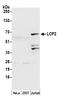 Lymphocyte Cytosolic Protein 2 antibody, A305-242A, Bethyl Labs, Western Blot image 