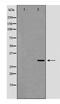 CD70 Molecule antibody, TA347946, Origene, Western Blot image 