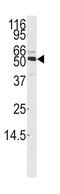 Calcium/Calmodulin Dependent Protein Kinase Kinase 1 antibody, abx033669, Abbexa, Western Blot image 