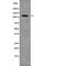 EPH Receptor A8 antibody, abx215186, Abbexa, Western Blot image 