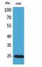 Insulin Like Growth Factor Binding Protein 6 antibody, A04101, Boster Biological Technology, Western Blot image 