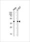 Phosphoglycerate Kinase 1 antibody, 62-655, ProSci, Western Blot image 