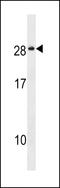 Sodium/Potassium Transporting ATPase Interacting 4 antibody, 59-686, ProSci, Western Blot image 