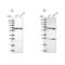 Acyl-CoA Dehydrogenase Family Member 9 antibody, PA5-58072, Invitrogen Antibodies, Western Blot image 