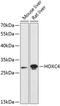 Homeobox C4 antibody, GTX66219, GeneTex, Western Blot image 