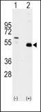 TNF Receptor Associated Factor 2 antibody, TA302132, Origene, Western Blot image 