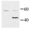 G Protein Subunit Alpha 15 antibody, PA1-29022, Invitrogen Antibodies, Western Blot image 