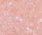 Tripartite Motif Containing 71 antibody, 5881, ProSci, Immunohistochemistry paraffin image 