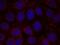 Insulin Like Growth Factor 1 Receptor antibody, PA5-37602, Invitrogen Antibodies, Immunofluorescence image 