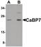 Calcium Binding Protein 7 antibody, PA5-21001, Invitrogen Antibodies, Western Blot image 