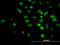 AKT Serine/Threonine Kinase 2 antibody, LS-C133859, Lifespan Biosciences, Immunofluorescence image 