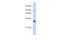 Leucine Rich Repeat Containing 57 antibody, 27-050, ProSci, Enzyme Linked Immunosorbent Assay image 