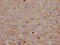 Carcinoembryonic antigen-related cell adhesion molecule 1 antibody, CSB-RA147192A0HU, Cusabio, Immunohistochemistry paraffin image 