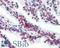 Solute Carrier Family 39 Member 6 antibody, LS-A9835, Lifespan Biosciences, Immunohistochemistry paraffin image 